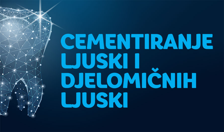 Tečaj Cementiranje ljuski i djelomičnih ljuski